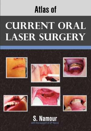 Atlas of Current Oral Laser Surgery de S. Namour