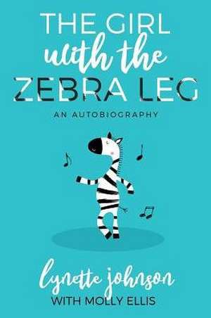 The Girl with the Zebra Leg de Lynette Johnson