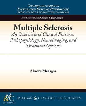 Multiple Sclerosis de Alireza Minagar