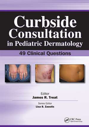 Curbside Consultation in Pediatric Dermatology: 49 Clinical Questions de James Treat