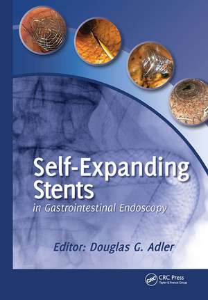 Self-Expanding Stents in Gastrointestinal Endoscopy de Douglas Adler