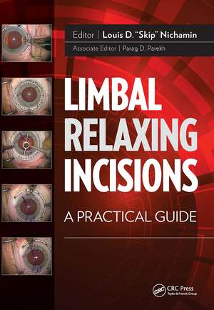 Limbal Relaxing Incisions: A Practical Guide de Louis D. Nichamin