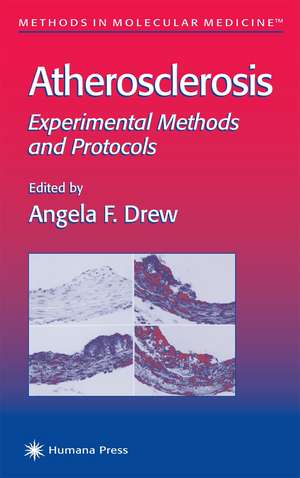 Atherosclerosis: Experimental Methods and Protocols de Angela F. Drew