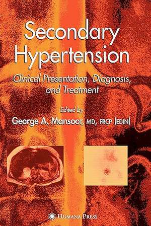 Secondary Hypertension: Clinical Presentation, Diagnosis, and Treatment de George A. Mansoor