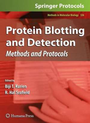 Protein Blotting and Detection: Methods and Protocols de Biji T. Kurien