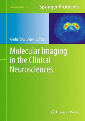 Molecular Imaging in the Clinical Neurosciences de Gerhard Gründer