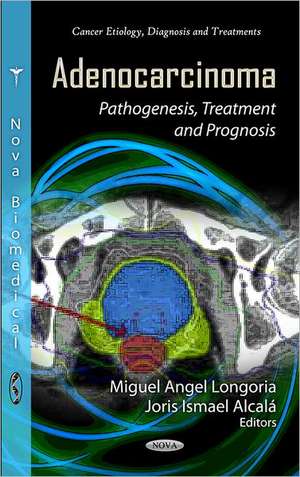 Adenocarcinoma de Miguel Angel Longoria