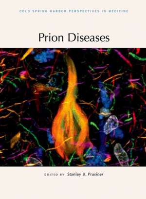 Prion Diseases de Stanley B Prusiner