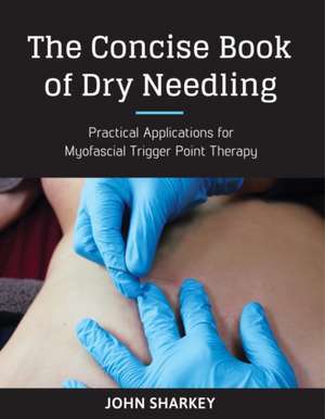 The Concise Book of Dry Needling: A Practitioner's Guide to Myofascial Trigger Point Applications de JOHN SHARKEY