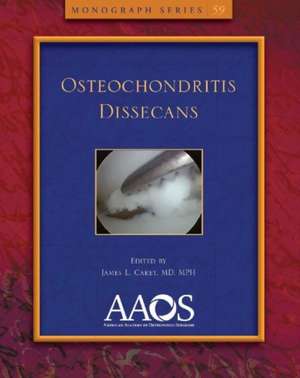 Osteochondritis Dissecans