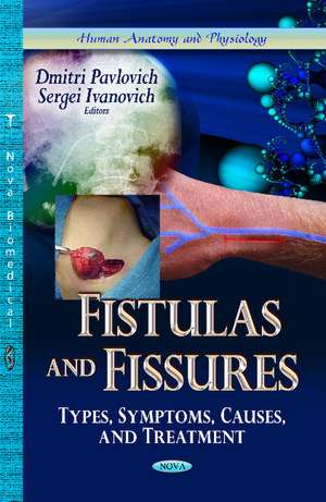 Fistulas & Fissures: Types, Symptoms, Causes & Treatment de Dmitri Pavlovich
