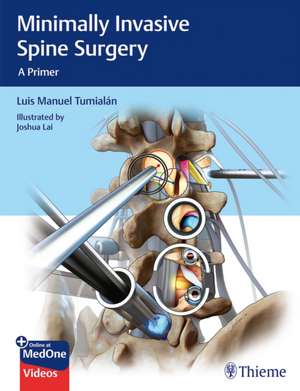 Minimally Invasive Spine Surgery – A Primer de Luis Manuel Tumialan