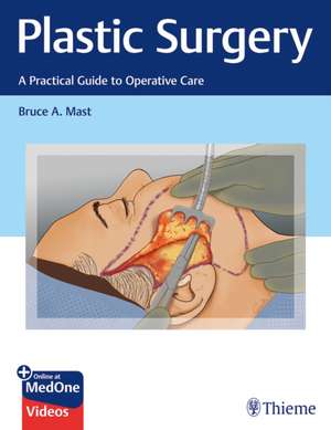 Plastic Surgery: A Practical Guide to Operative Care de Bruce A. Mast