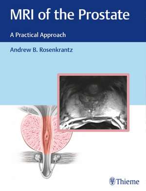 MRI of the Prostate – A Practical Approach de Andrew Rosenkrantz