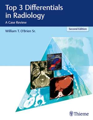 Top 3 Differentials in Radiology – A Case Review de William T. O`brien