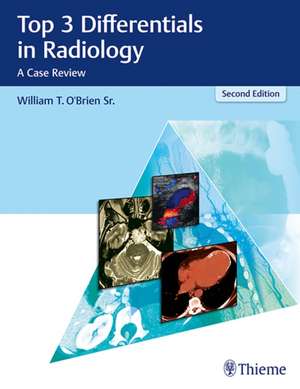 Top 3 Differentials in Radiology de William T. O'Brien