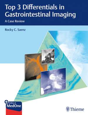 Top 3 Differentials in Gastrointestinal Imaging – A Case Review de Rocky C. Saenz