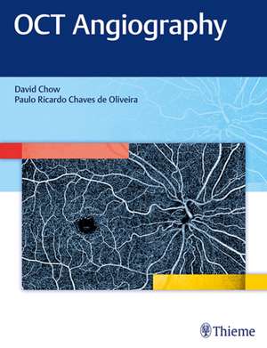 OCT Angiography de David Chow