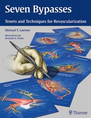 Seven Bypasses – Tenets and Techniques for Revascularization de Michael T. Lawton