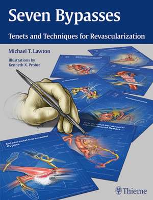 Seven Bypasses de Michael T. Lawton