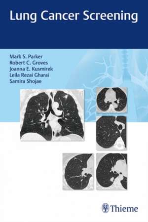 Lung Cancer Screening de Parker