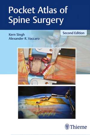 Pocket Atlas of Spine Surgery de Kern Singh