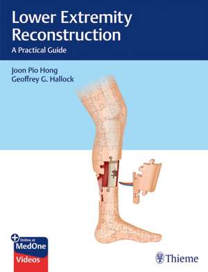 Lower Extremity Reconstruction de J Hong