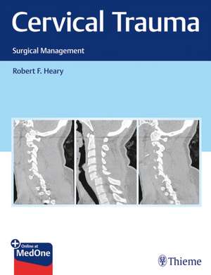 Cervical Trauma – Surgical Management de R Heary