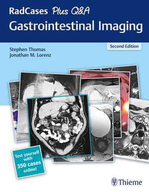 RadCases Plus Q&A Gastrointestinal Imaging de Stephen Thomas