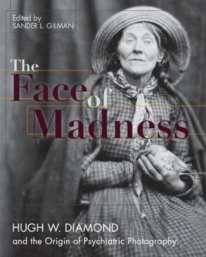 Face of Madness: Hugh W. Diamond and the Origin of Psychiatric Photography de Sander L Gilman