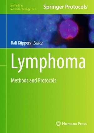 Lymphoma: Methods and Protocols de Ralf Küppers