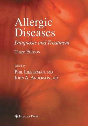 Allergic Diseases: Diagnosis and Treatment de Phil Lieberman