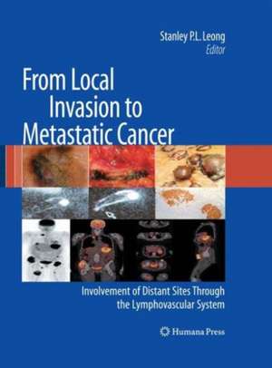 From Local Invasion to Metastatic Cancer: Involvement of Distant Sites Through the Lymphovascular System de Stanley P. L. Leong