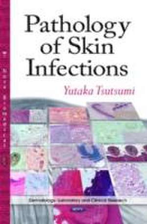 Pathology of Skin Infections de Yutaka Tsutsumi