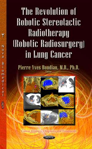 The Revolution of Robotic Stereotactic Radiotherapy (Robotic Radiosurgery) in Lung Cancer de Pierre-Yves Bondiau