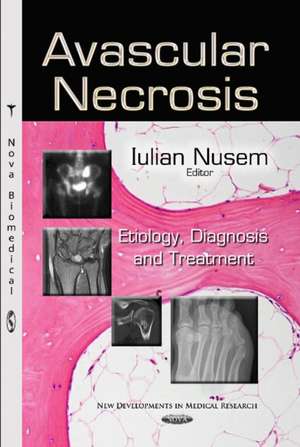 Avascular Necrosis de Iulian Nusem