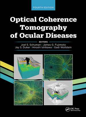 Optical Coherence Tomography of Ocular Diseases de Joel S. Schuman