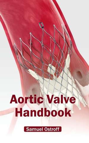 Aortic Valve Handbook de Samuel Ostroff