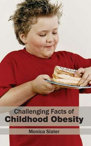 Challenging Facts of Childhood Obesity de Monica Slater