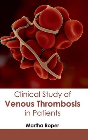 Clinical Study of Venous Thrombosis in Patients de Martha Roper