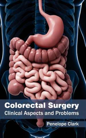 Colorectal Surgery de Penelope Clark