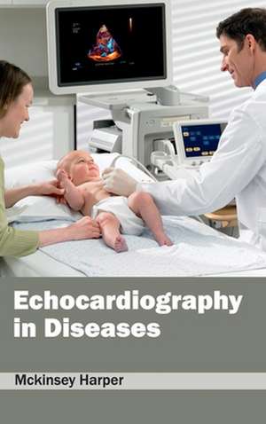 Echocardiography in Diseases de Mckinsey Harper