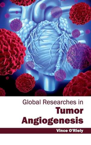 Global Researches in Tumor Angiogenesis de Vince O'Riely