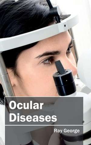 Ocular Diseases de Ray George