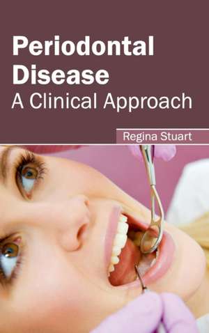 Periodontal Disease de Regina Stuart