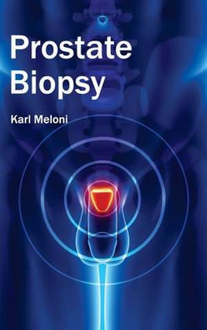 Prostate Biopsy de Karl Meloni