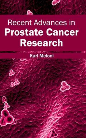 Recent Advances in Prostate Cancer Research de Karl Meloni