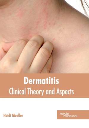 Dermatitis de Heidi Mueller