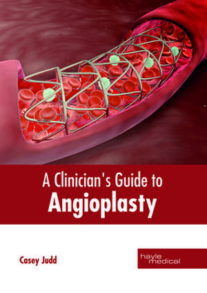 A Clinician's Guide to Angioplasty de Casey Judd