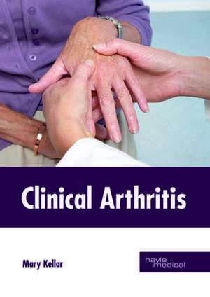 Clinical Arthritis de Mary Kellar